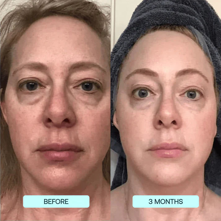 Lifting Collagen Patches (10 Full-Face Treatments)