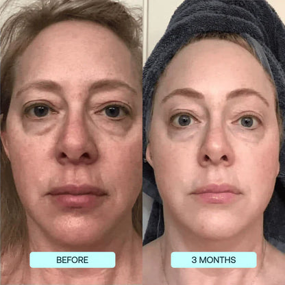 Lifting Collagen Patches (10 Full-Face Treatments)