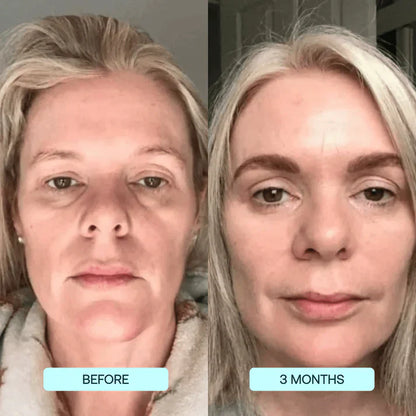 Lifting Collagen Patches (10 Full-Face Treatments)